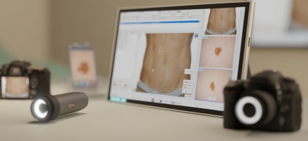 Software DDAVL-HD per la Dermatologia - Software per Dermatologia e Dermatoscopia 